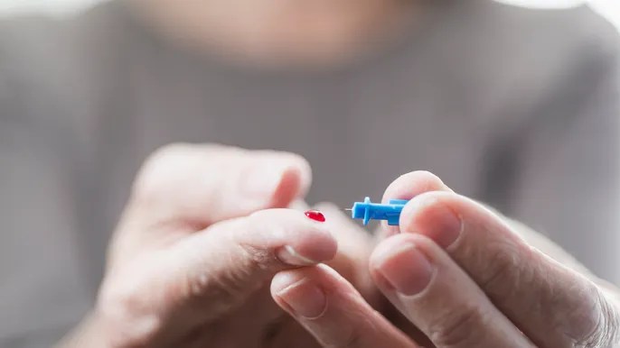 Alzheimer’s disease may be detected by a finger prick blood test for earlier diagnosis and&nbsp;treatment